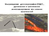 Ультразвуковая допплерография (УЗДГ) , дуплексное и триплексное ангиосканирование вен нижних конечностей
