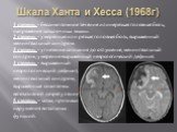 Шкала Ханта и Хесса (1968г). 1 степень - бессимптомное течение или нерезкая головная боль, напряжение затылочных мышц. 2 степень - умеренная или резкая головная боль, выраженный менингеальный синдром. 3 степень - угнетение сознания до оглушения, менингеальный синдром, умеренно выраженный неврологиче