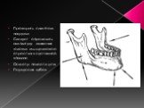 Проверить симптом нагрузки Следует определить амплитуду движения головки мыщелкового отростка в суставной впадине Осмотр полости рта Перкуссия зубов