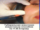 Клинико-анатомическое обоснование проводниковой анестезии                               ( туберальной, подглазничной, резцовой, небной) на верхних зубах Слайд: 16
