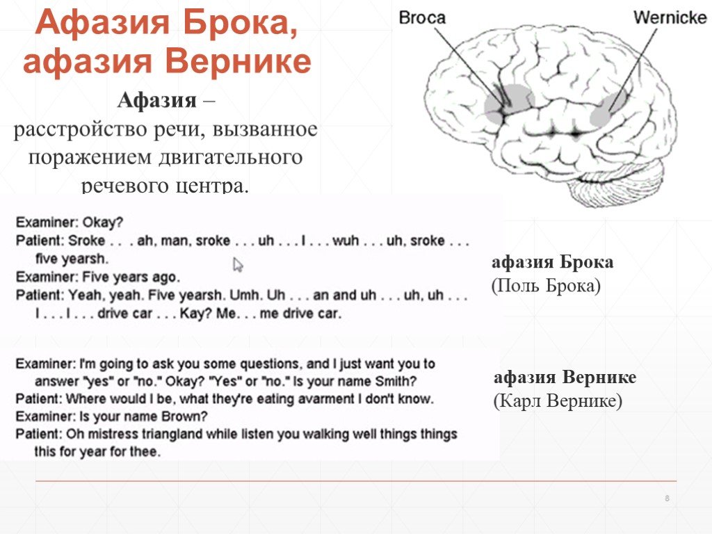 Афазия речи. Сенсорная корковая афазия Брока-Вернике. Зона Брока афазия. Афазия Брока и афазия Вернике. Центр Вернике сенсорная афазия.