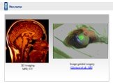 Медицина. Image guided surgery Grimson et al., MIT. 3D imaging MRI, CT