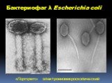 Бактериофаг λ Escherichia coli. «Портрет» электронномикроскопический