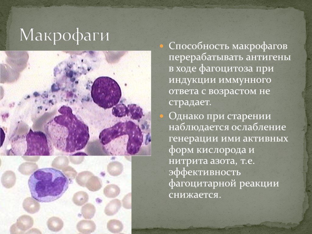 Роль макрофагов. Макрофаги гистиоциты. Макрофаги в крови. Форма макрофагов. Подвижные макрофаги.