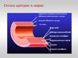 Стенка артерии в норме. Эндотелий Субэндотелиальный слой Внутренняя мембрана гладкомышечные клетки коллаген Внешняя мембрана. наружная соединительнотканная оболочка кровеносного сосуда. Средняя оболочка сосуда. Интима