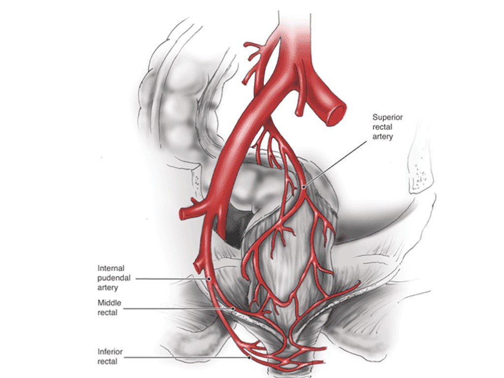 Правая подвздошная артерия. Кровоснабжение прямой кишки артерии. Верхняя прямокишечная артерия. Средняя прямокишечная артерия. Артерии таза анатомия.