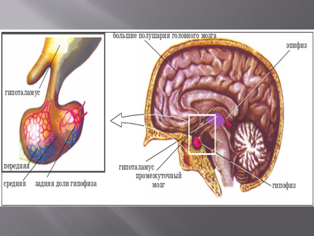 Формирующееся турецкое седло в головном мозге