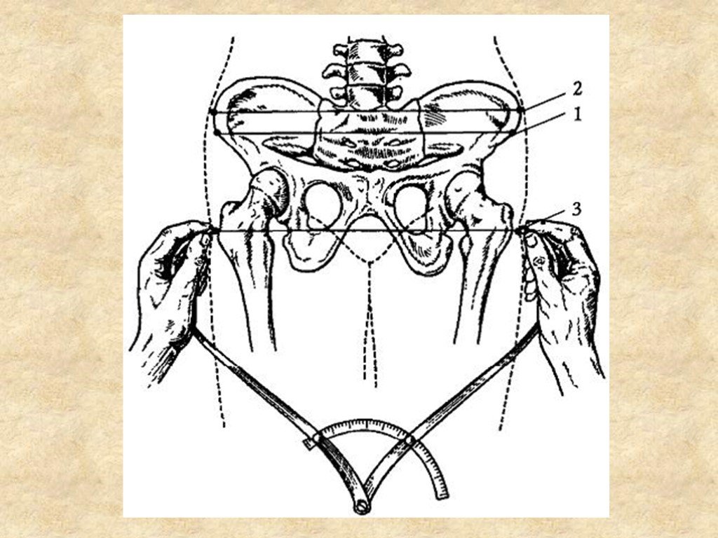 Исследование таза. Спинарум кристарум. Измерение наружных размеров таза пельвиометрия алгоритм. Измерение наружного таза женщины. Измерение таза тазомером.