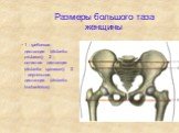 Размеры большого таза женщины. 1 - гребневая дистанция (distantia cristarum); 2 - остистая дистанция (distantia spinarum); 3 - вертельная дистанция (distantia trochanterica).