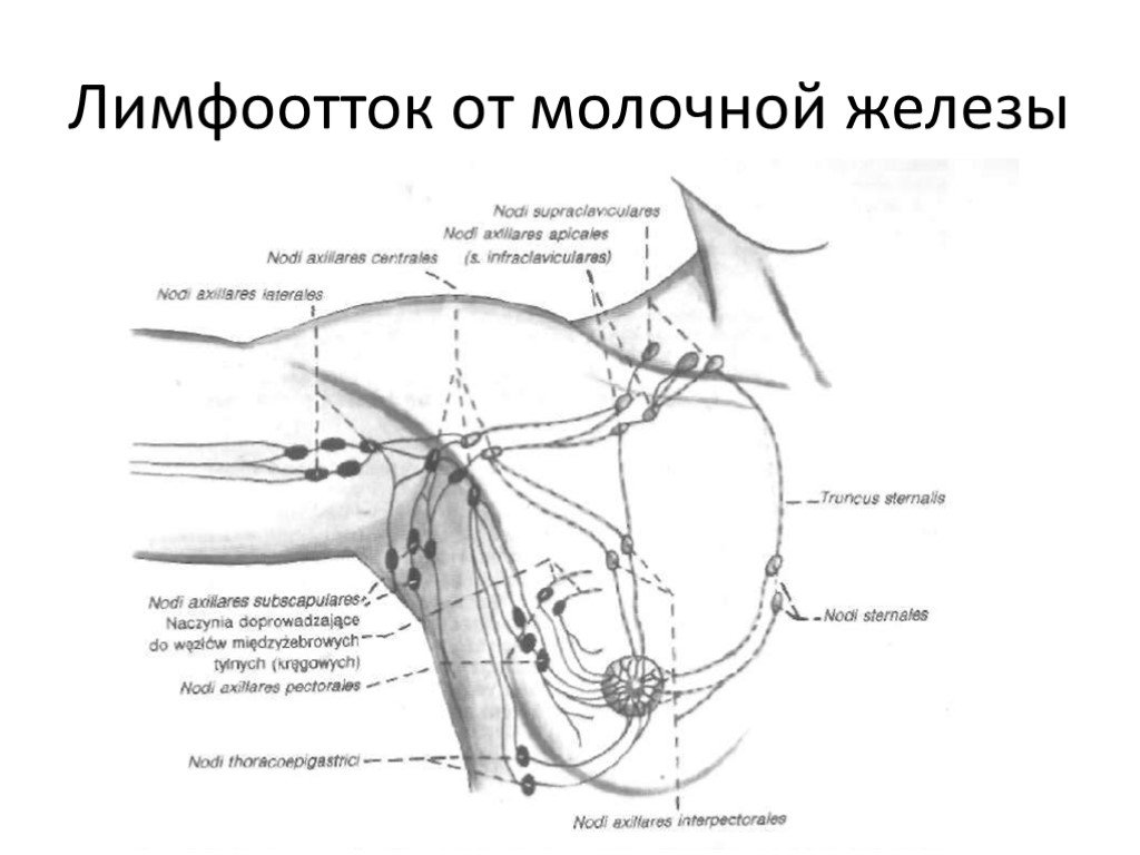 Лимфатические узлы груди. Регионарные лимфоузлы грудной железы. Молочная железа лимфоотток топографическая анатомия. Лимфоузлы подмышечной области схема. Лимфатические узлы молочной железы схема.