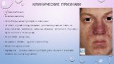 Триада симптомов: Кожные изменения, Эпилептиформные припадки и слабоумие. В легких случаях обнаруживаются депигментированные пятна на коже, узелковые высыпания (adenoma sebaceum) величиной с просяное зерно на лице и подбородке, Подногтевые фибромы, Поражение сетчатки, других отделов глаз, Опухоли се