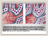 Перицентральный фиброз печени. Расположение внеклеточной ткани вокруг гепатоцита около центральной вены препятствует нормальному движению крови по синусоидным каппилярам. Иллюстрация: Friedman, S.L. Scarring in alcoholic liver disease: New insights and emerging therapies // Alcohol Health & Rese