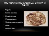 Операции на поврежденных органах и тканях: Черепе Головном мозге Позвоночнике Спинном мозге Органы груди и живота Кости Органы таза