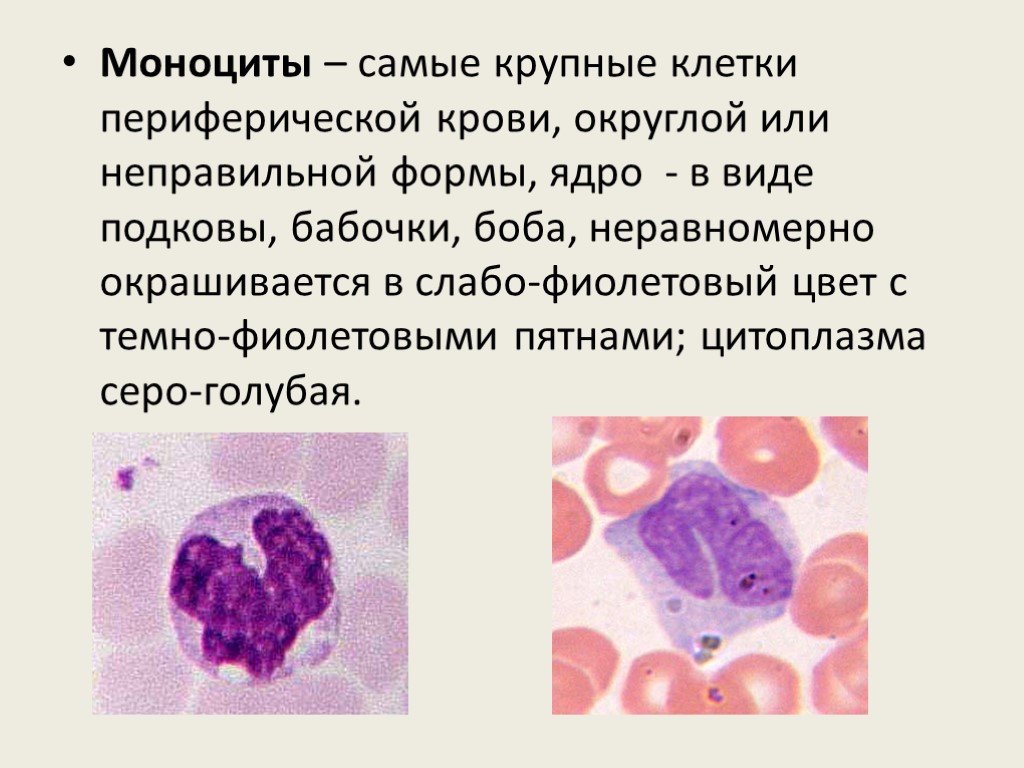 Моноцитов в крови 1