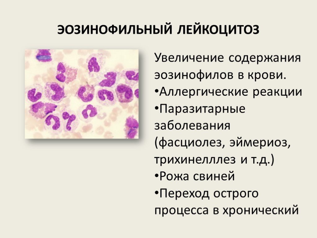 Эозинофилы в крови понижены что это значит