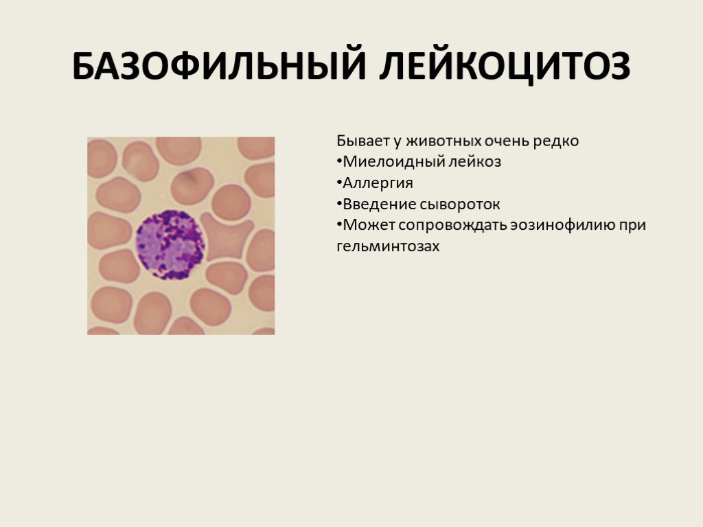 Эозинофильный лейкоцитоз. Базофильный лейкоцитоз характерен для. Механизм развития базофильного лейкоцитоза. Острый базофильный лейкоз. Базофильный лейкоцит микропрепарат.