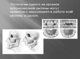 Патологии одного из органов зубочелюстной системы могут привести к нарушениям в работе всей системы в целом.