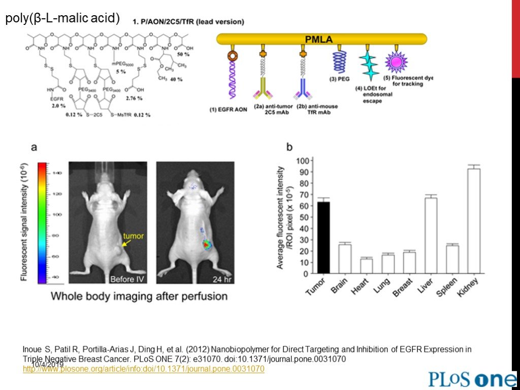 H et al 2012. Inoue классификация. Chen z. et al. // PLOS one, 2013, v. 8.