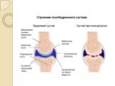 Заболевания суставов-диагностика и лечение Слайд: 32