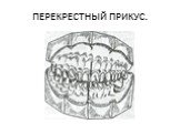 . Анатомия зубных рядов Слайд: 23