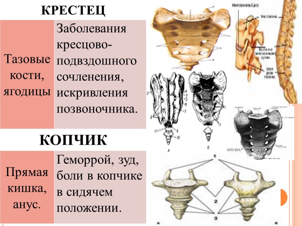 Крестцовые боли. Боль в копчике психосоматика. Болит крестец психосоматика причины у женщин. Психосоматика копчика крестца.