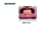 Тема: Пороки развития уздечек губ и языка,мелкоепредверие полости рта Слайд: 7