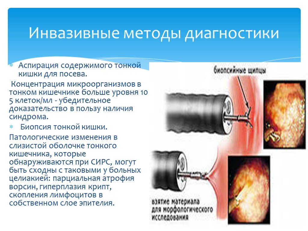 Инвазивный вид. Аспирация содержимого тонкой кишки. Инвазивные методы диагностики. Инвазивный метод диагностики. Аспирационная биопсия тонкого кишечника.