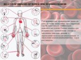 Места прижатия артерий при кровотечениях. При артериальное кровотечении кровь из раны вытекает алого цвета пульсирующей струей, представляет наибольшую опасность для жизни. Первая помощь при артериальном кровотечении состоит в пальцевом прижатии артерии к подлежащей кости выше места ранения и наложе