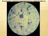 Нервная клетка ( гранулярная эндоплазматическая сеть, базофильное вещество ).