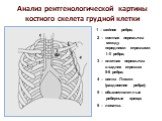 Анализ рентгенологической картины костного скелета грудной клетки. 1 – шейное ребро; 2 – костная перемычка между передними отрезками I–II ребра; 3 – плотная перемычка в задних отрезках 5-6 ребра; 4 – вилка Люшки (раздвоение ребра); 5 – обызвествленные реберные хрящи; 6 – лопатка.
