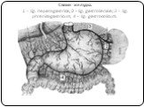 Связки желудка. 1 – lig. hepatogastrica; 2 – lig. gastrolienale; 3 – lig. phrenicogastricum; 4 – lig. gastrocolicum.