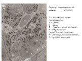 Ацинус поджелудочной железы Х 1600 1 - базальный отдел панкреоцита; 2 – ГЭПР; 3 – ядро; 4 – пластинчатый аппарат; 5 - секреторные (зимогенные) гранулы; 6- центроацинозные клетки; 7- просвет ацинуса.