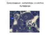 Синусоидные капилляры и клетки Купффера