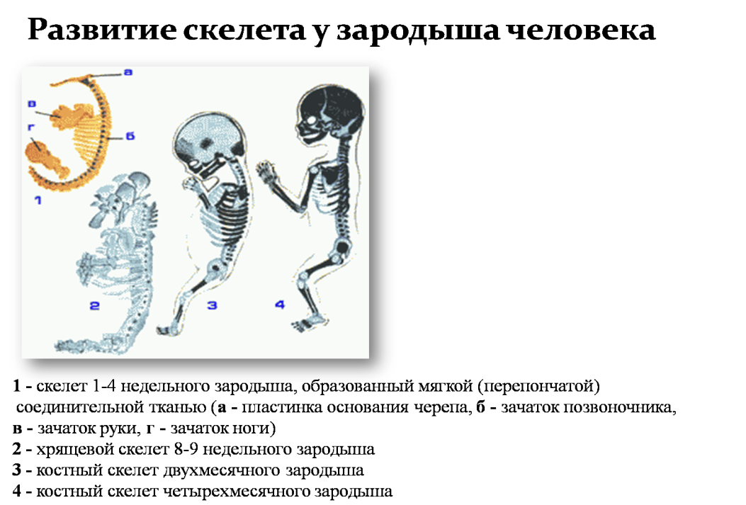 Этапы формирования скелета. Развитие скелета человека. Стадии развития скелета человека. Костная стадия развития скелета. Женщина с нарушением в развитии скелета