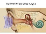 Патология органов слуха