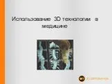 Использование 3D технологии в медицине